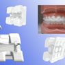 Esther® MB BRACKETS